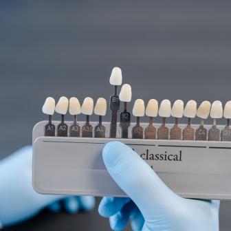 Perfekte Farbgebung für Ihren Zahnersatz