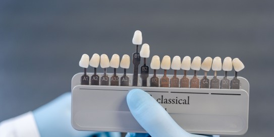 Perfekte Farbgebung für Ihren Zahnersatz