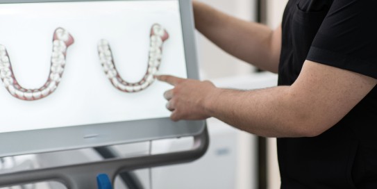 Mehr Komfort mit dem Intraoralscanner